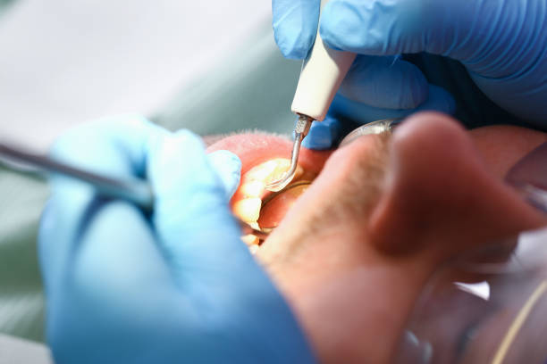 Best Pediatric Emergency Dentist in Dresden, OH