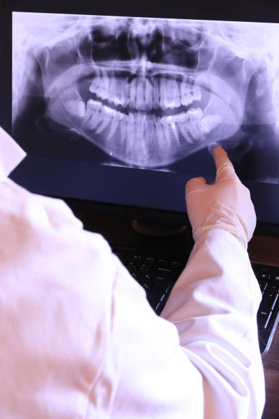 Best Emergency Treatment for Dental Infections or Abscesses in Dresden, OH
