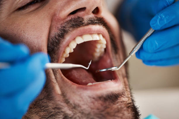 Best Emergency TMJ Treatment in Dresden, OH