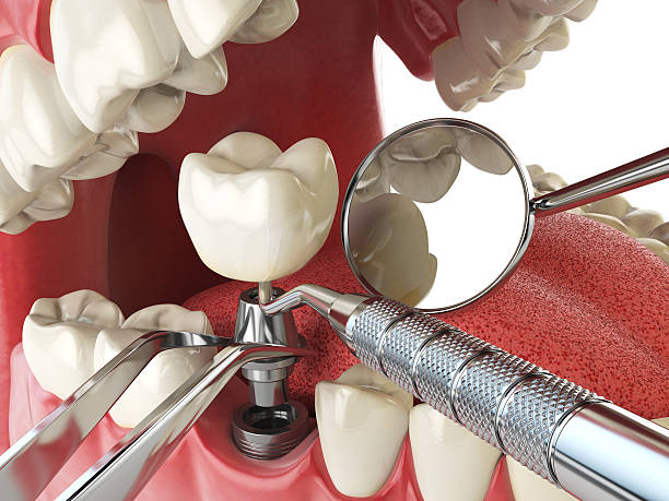 Best Emergency Gum Treatment in Dresden, OH